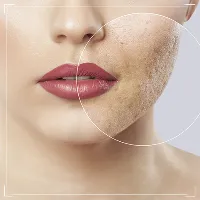 Про салициловую кислоту